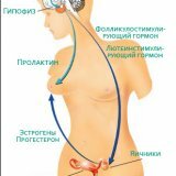 Нарушение менструального цикла аменорея